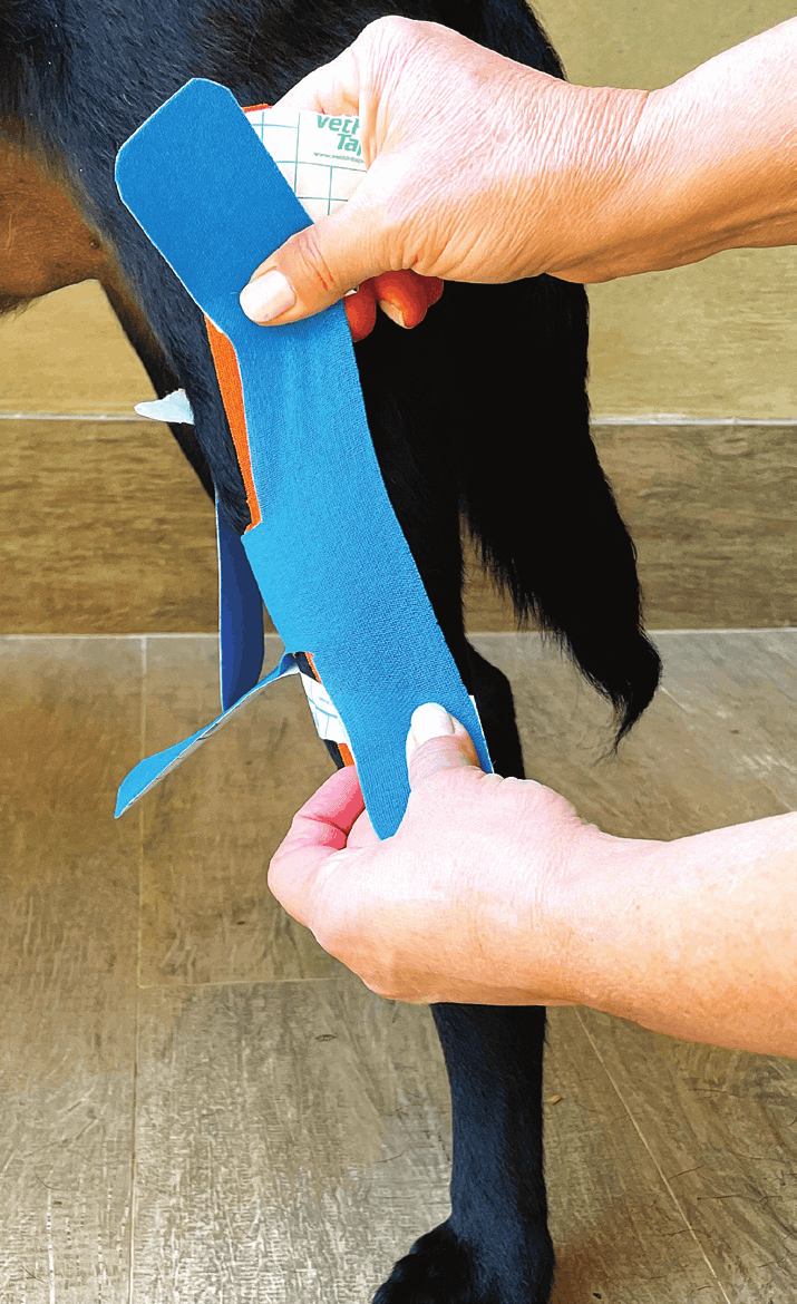 Applying a second reinforcing H tape, lateral view