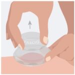 How-to-illustration-cupping-set-of-4(2)