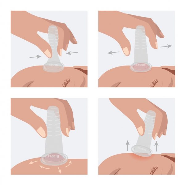 How-to-illustration-facial-cupping-set