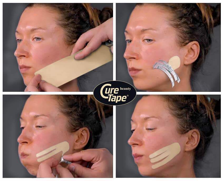 Taping wrinkles in the lower face - Thysol United Kingdom