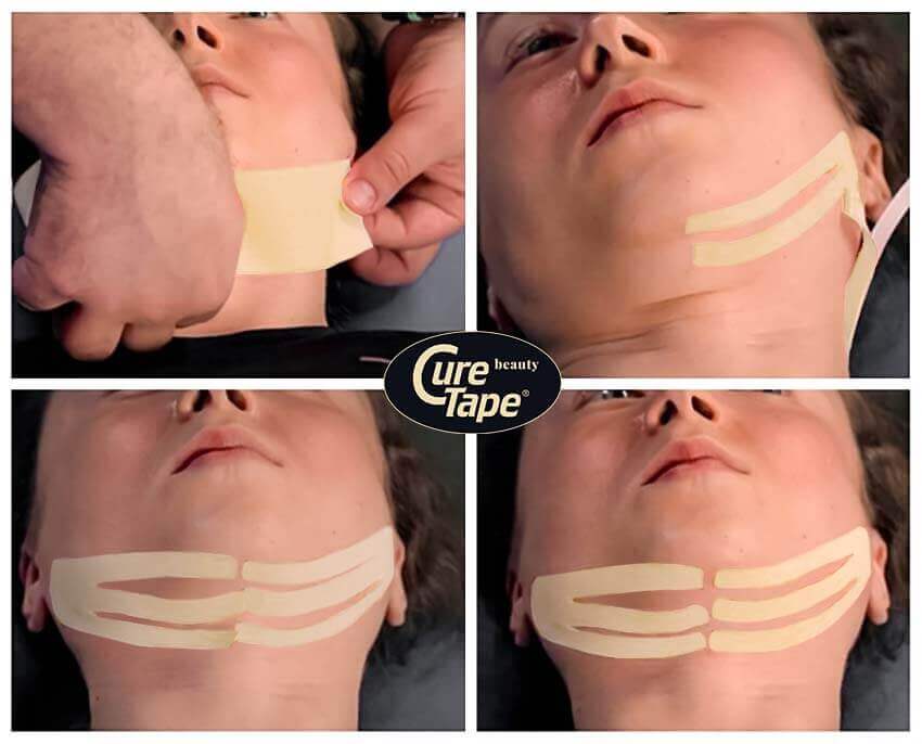 Taping under chin with beauty tape - Thysol United Kingdom